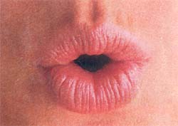 Губы не сомкнуты, собраны в складки, нижняя губа отвернута наружу. Отчетливо видна граница красной каймы и слизистой оболочки губ.