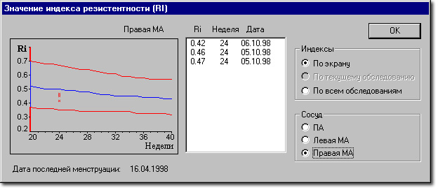 Sonomed-300/A screenshot