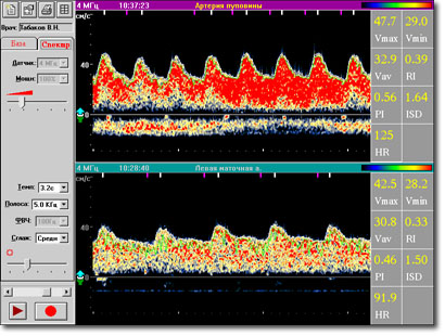 Sonomed-300/A screenshot